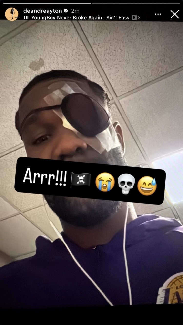 开云体育-明日洛杉矶德比 艾顿可以出战！里夫斯与蒂耶罗继续缺席